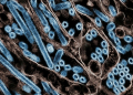 A colorized transmission electron micrograph of avian influenza A H5N1 virus particles (blue), grown in Madin-Darby Canine Kidney (MDCK) epithelial cells. ©AFP