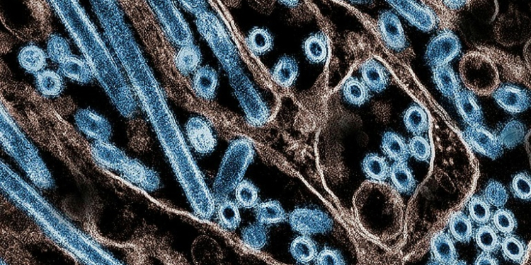 A colorized transmission electron micrograph of avian influenza A H5N1 virus particles (blue), grown in Madin-Darby Canine Kidney (MDCK) epithelial cells. ©AFP